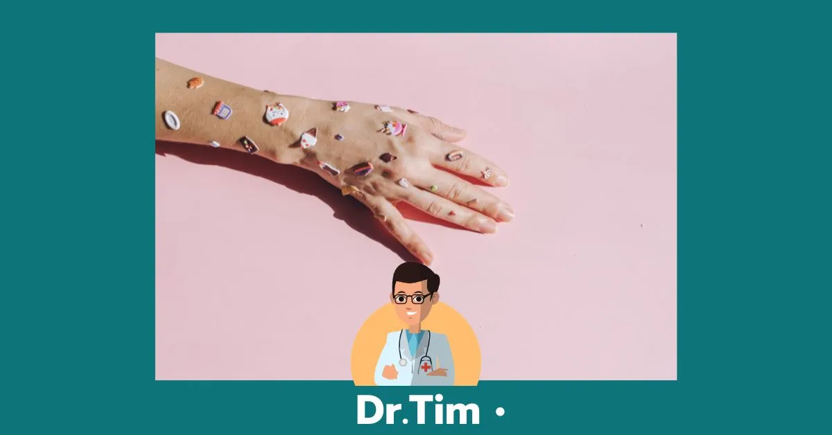 3 สัญญาณทางผิวหนังทำนายเบาหวาน