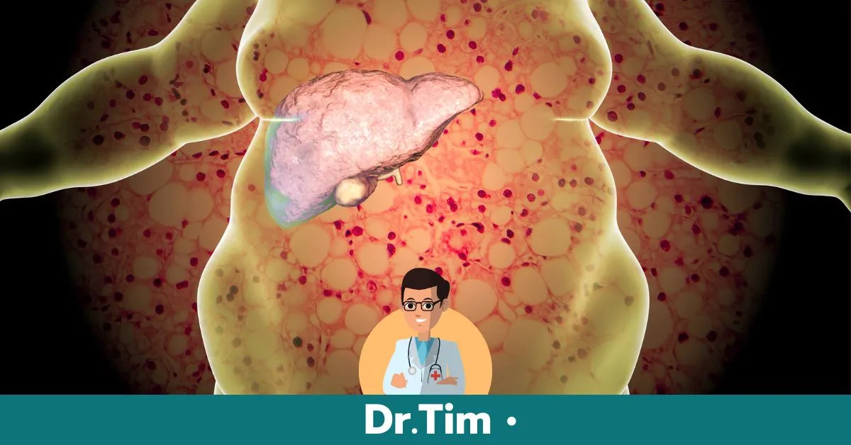 รู้จักกับไขมันพอกตับ