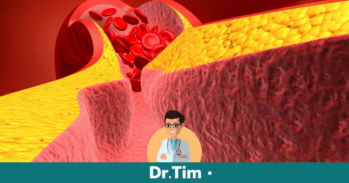 หลอดเลือดแดงตีบและแข็ง